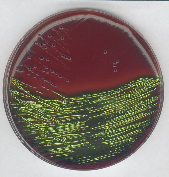 EMB agar for the detection and isolation of pathogenic Enterobacteriaceae-500g 1013470500