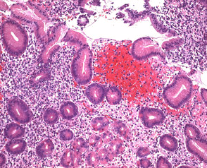 Eosin B (bluish) (C.I.45400) for microscopy Certistain® Merck Đức 1159340100