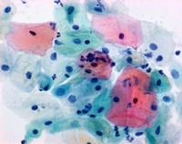 Papanicolaou's solution 1a Harris' hematoxylin solution 1l Merck 1092531000