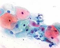 Papanicolaou's solution 1b Hematoxylin solution S for cytological cancer and cycle diagnosis 500ml Merck 1092540500
