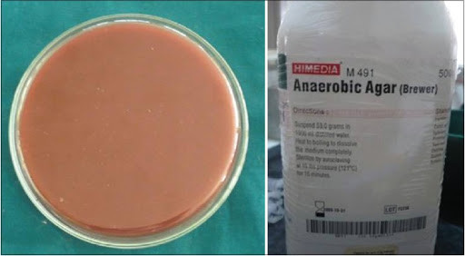 Anaerobic Agar (Brewer) 500g Himedia GM491-500G